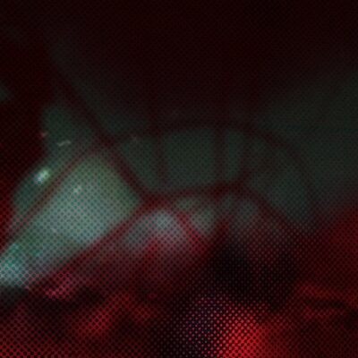 Shamania (Inc Villalobos & Melchior and Dunkle Dummies Remixes)